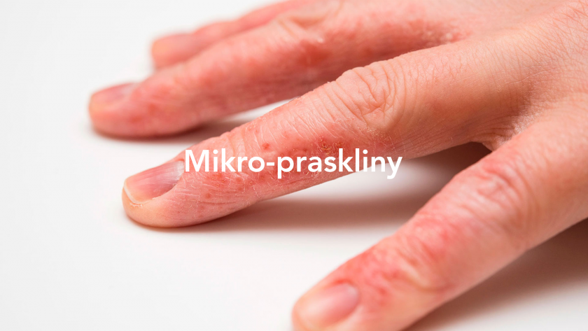 mikro-praskliny