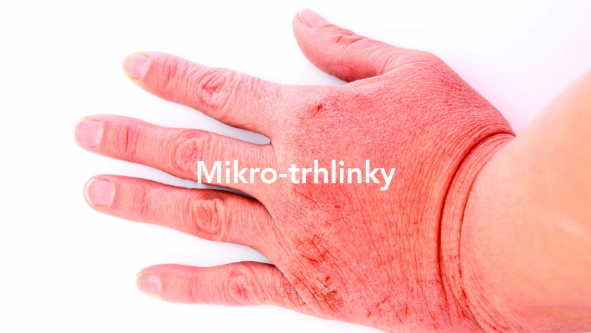 mikro-trhlinky