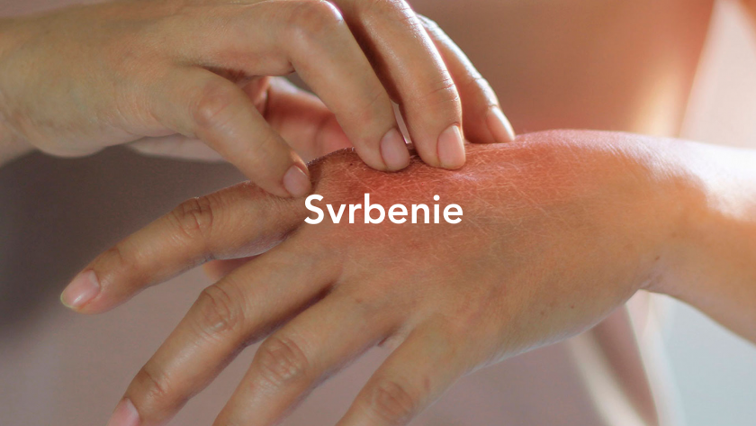 svrbenie