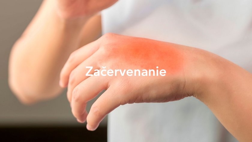 zacervenanie