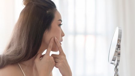 Woman touching her pimples