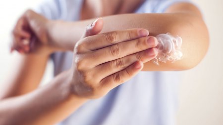 Eczema cream for adults